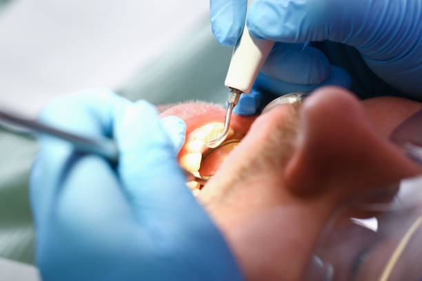 Best Emergency Root Canal Treatment in Marbleton, WY